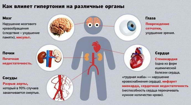 Сужение сосудов головного мозга, лечение и симптомы суженных сосудов головы