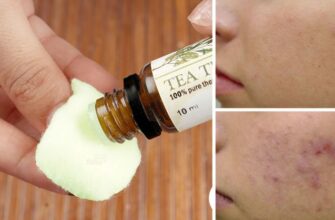 10 причин, по которым вы должны нанести масло чайного дерева на кожу прямо сейчас