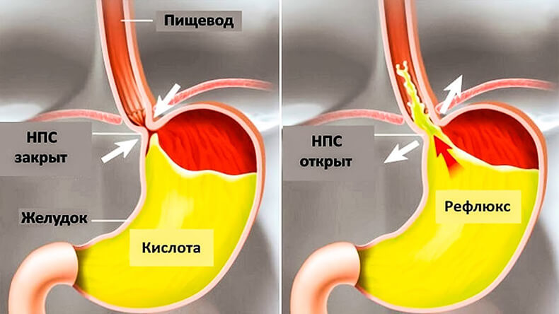 Как избавиться от лишнего веса и жира: Способ, который работает!