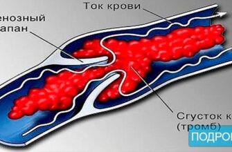 Не хочешь тромбов, просто пей этот коктейль!