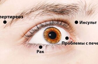 8 сигналов, при помощи которых глаза предупреждают о проблемах со здоровьем! Обрати внимание!