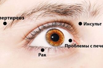 Ваши глаза могут рассказать о здоровье всего организма. 14 вещей!