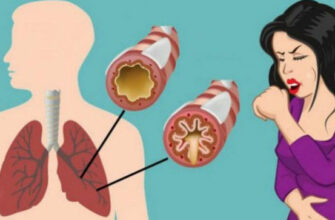 Как устранить слизь и мокроту из горла и груди (мгновенный результат)