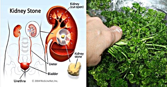 Как использовать петрушку для лечения почек, растворения камней в почках и детокса печени