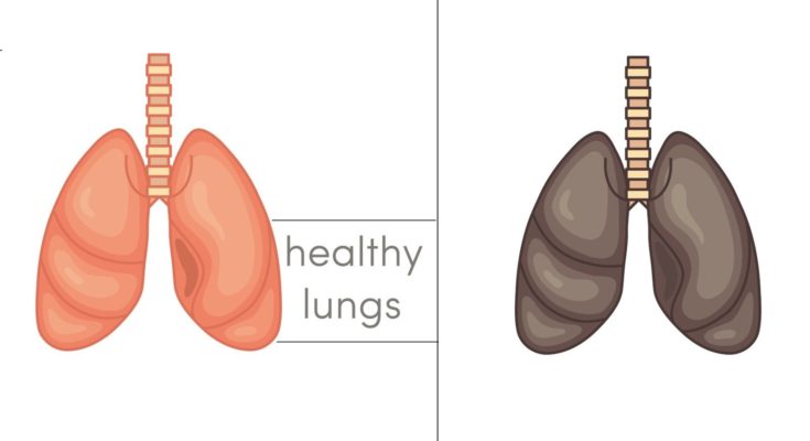 5 продуктов, которые детоксицируют и исцеляют ваши легкие естественным способом