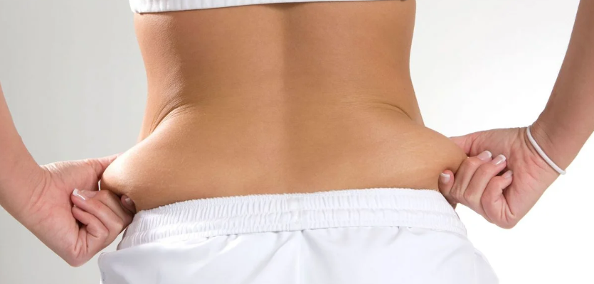 Синдром Венеры: убираем жировые подушки на бедрах и талии