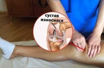 MОЩНЫЙ РЕЦЕПТ ДЛЯ ВОССТAНОВЛЕНИЯ СYСТAВОВ