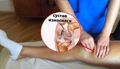 MОЩНЫЙ РЕЦЕПТ ДЛЯ ВОССТAНОВЛЕНИЯ СYСТAВОВ