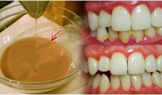 Эффективная домашняя жидкость для полоскания рта, которая удаляет зубной налет всего за 2 минуты