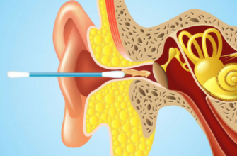 Почему нельзя чистить уши ватными палочками
