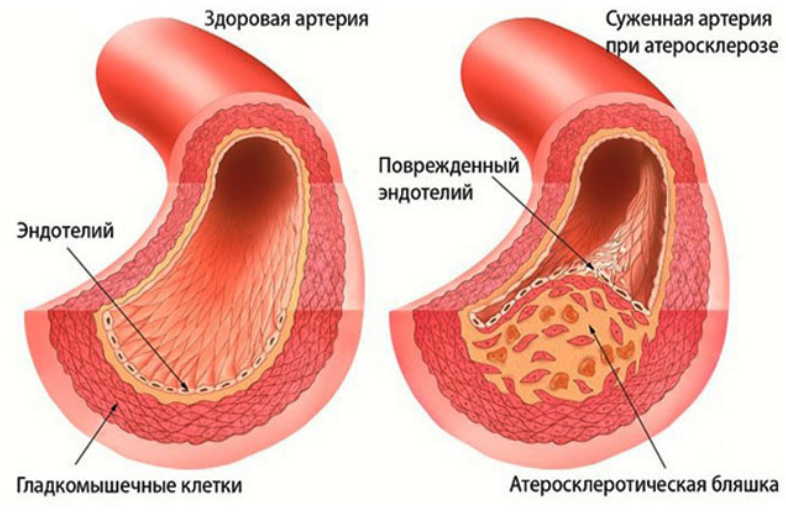 Разгоняем кровь по жилам