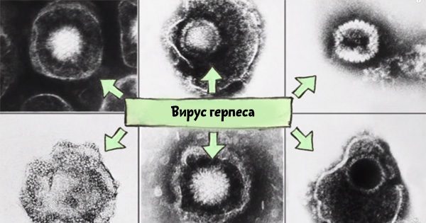 Чем опасен вирус герпеса?