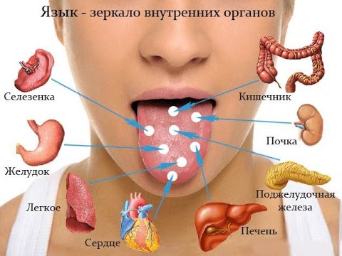 Болезни, о которых может рассказать ваш язык