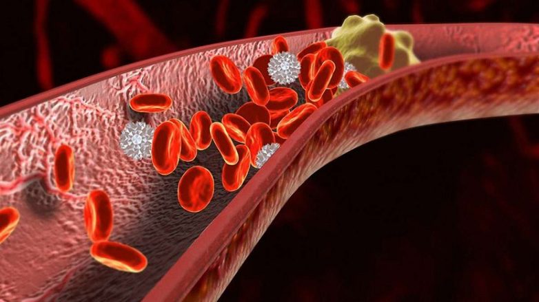 Первые признаки появления смертоносных тромбов