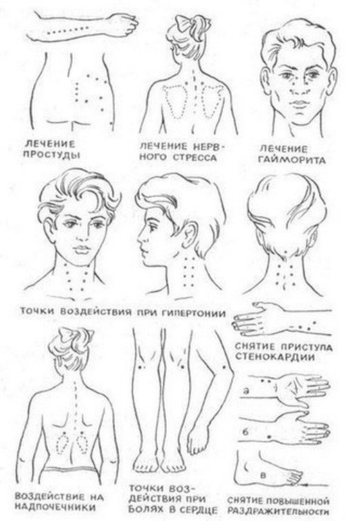 Снятие боли по древнекитайской методике