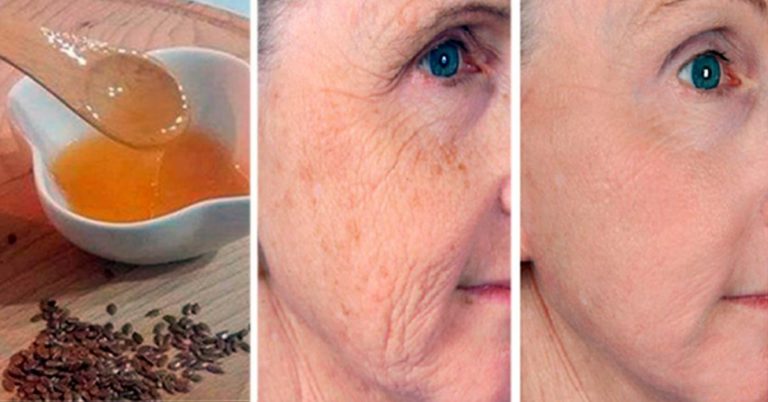 Подтянуть кожу, избавиться от морщин, а также устранить пятна на лице вам поможет этот метод!