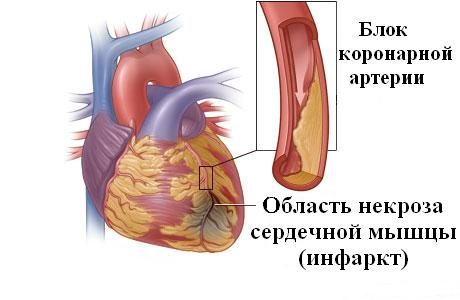 Вот почему полезно пить воду по утрам!