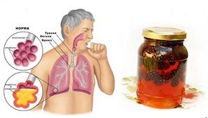 Лекарственные растения для очищения бронхов и легких