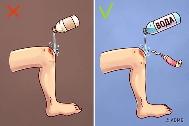 10 известных приемов первой помощи, которые 90 % людей делают неправильно