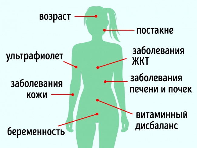 10 средств для кожи, которые стирают пигментные пятна как ластик