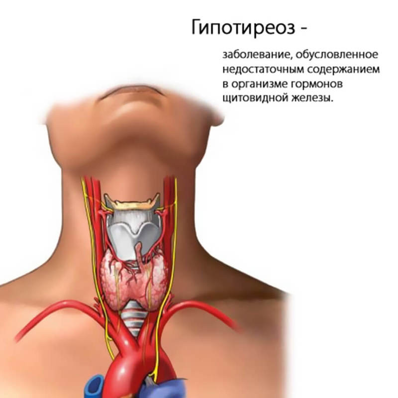 10 проблем со здоровьем, на которые указывает наш мочевой пузырь