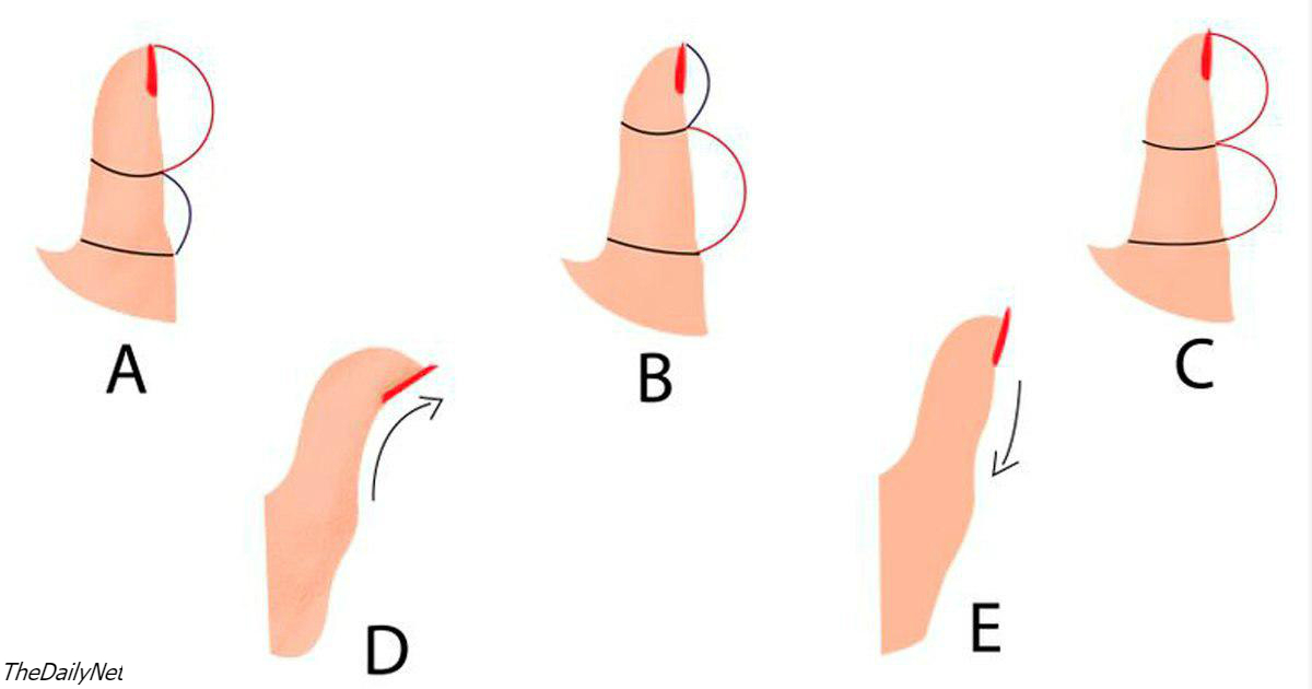 Вот как ваш характер зависит от формы вашего большого пальца
