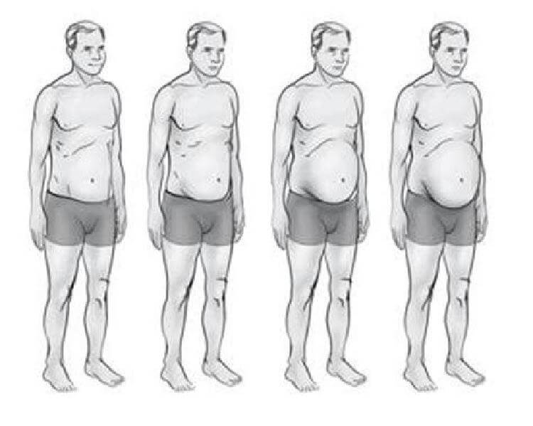Какой у вас гормональный сбой в организме: Легко узнать по типу фигуры