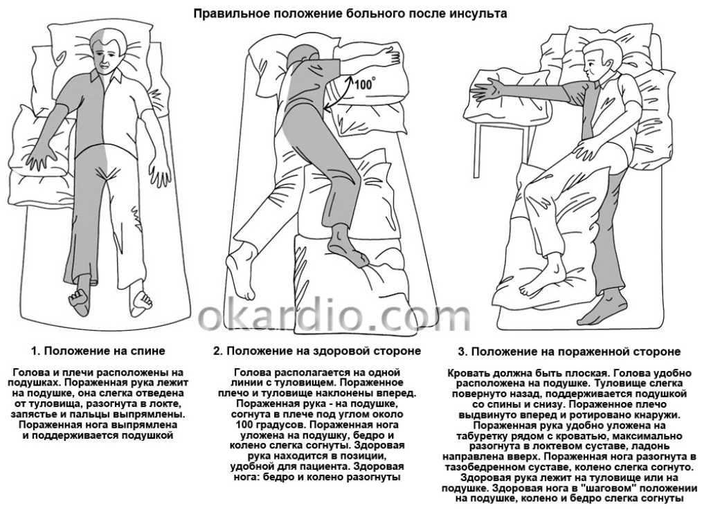 После инсульта болит парализованная рука и нога