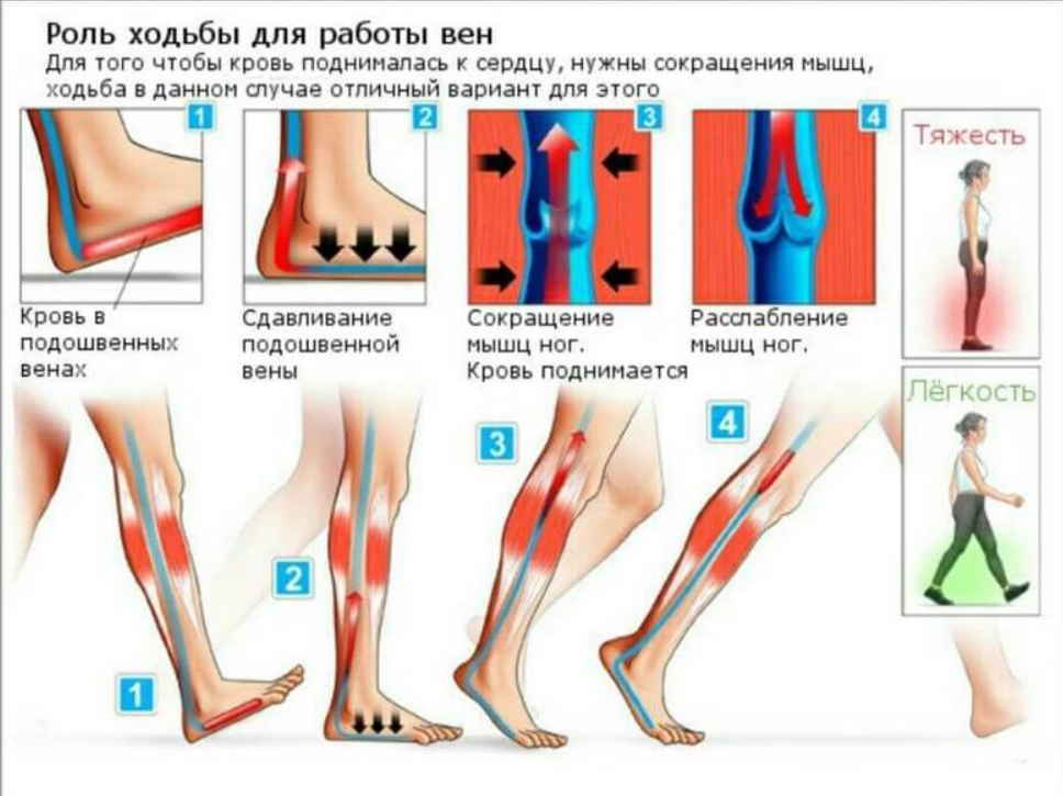 Гимнастика для сосудов: 15 упражнений, полезных при варикозе