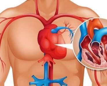 Вот как очистить артерии сердца с помощью природных средств: 2 рецепта