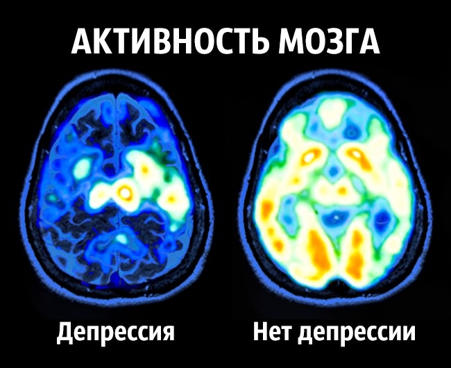 8 советов нейробиолога о том, как стать счастливым раз и навсегда